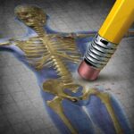 Calcium Supplements Increasing your Breast Cancer Risk -a skeleton drawing and a pencil eraser