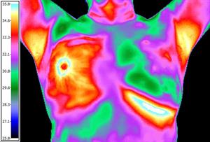 thermagram of womans chest