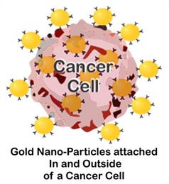 gold_nanoparticle and cancer - Beat Cancer Blog