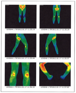 Thermogram-1-12-pg-8 Beat Cancer Blog